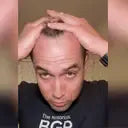 ๐ฟโจ FEG Hair Growth Spray โ Stop Hair Fall, Regrow Naturally & Strengthen Roots ๐ง๐ช